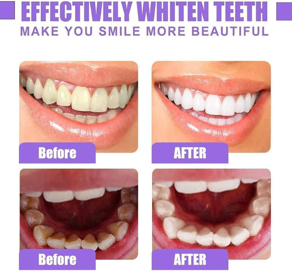 Jan London Teeth Whitening Foam for Aligners and Retainers