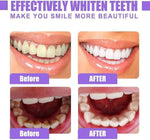Jan London Teeth Whitening Foam for Aligners and Retainers