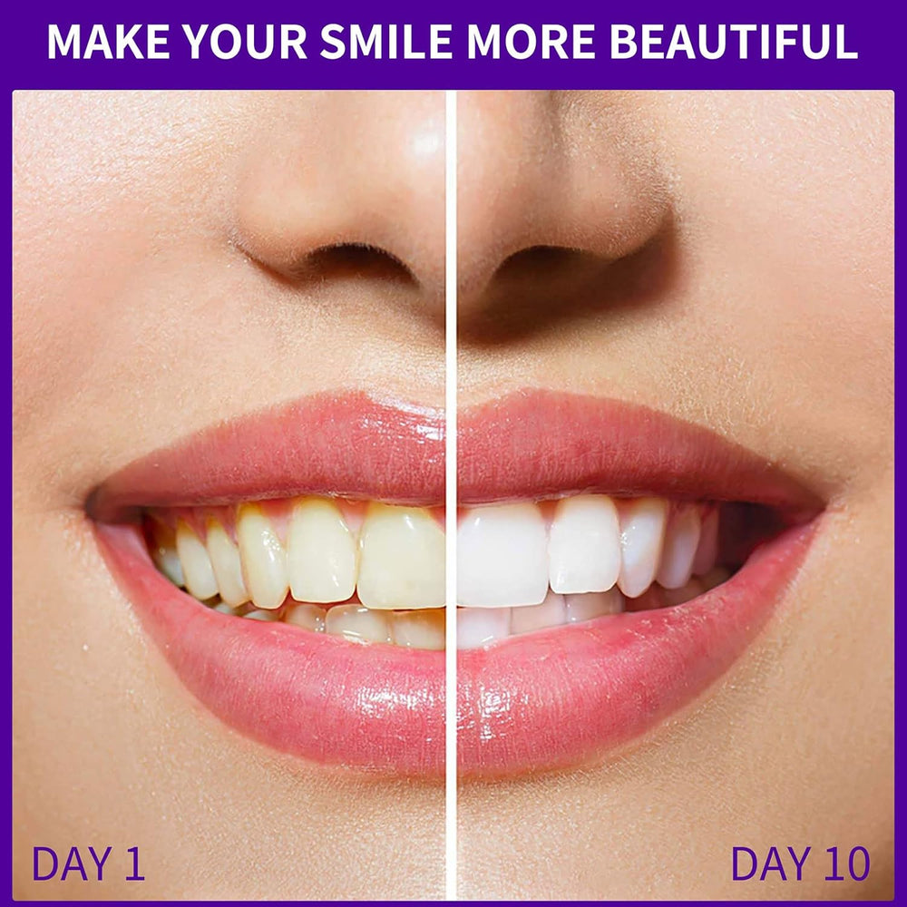 Jan London Teeth Whitening Foam for Aligners and Retainers