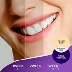 Jan London Teeth Whitening Foam for Aligners and Retainers