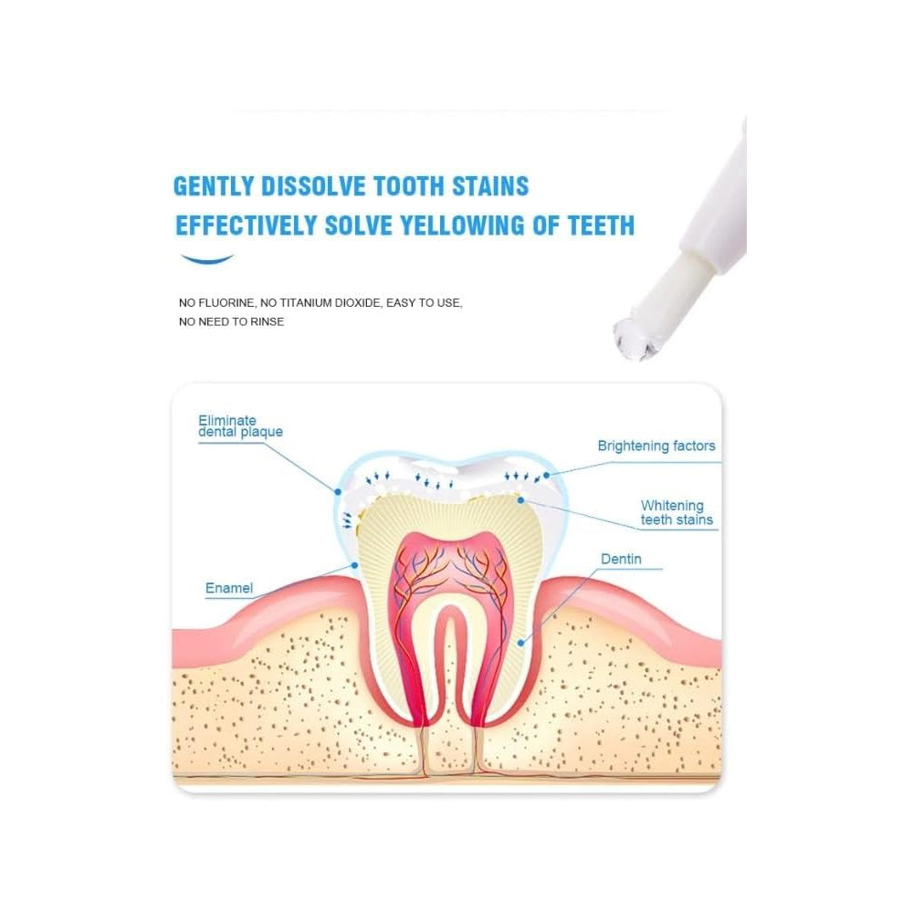 Jan London Advanced Teeth Whitening Pen for Brighter Enamel Safe Smile
