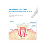 Jan London Advanced Teeth Whitening Pen for Brighter Enamel Safe Smile