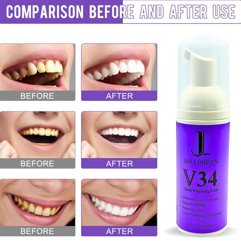 Jan London Teeth Whitening Foam for Aligners and Retainers
